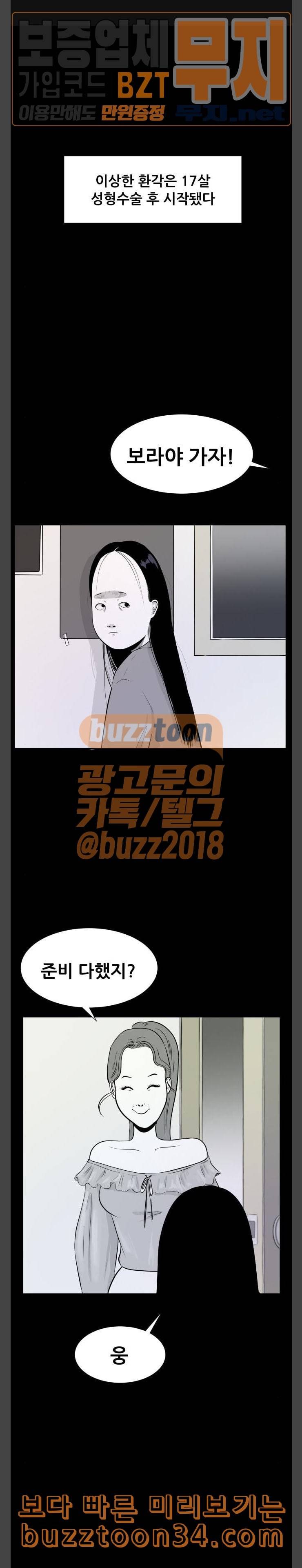두번째 생일 성형수술 1