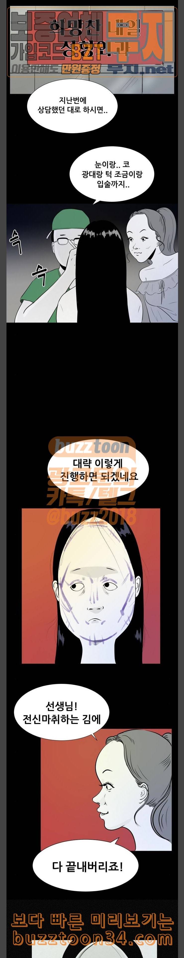 두번째 생일 성형수술 2