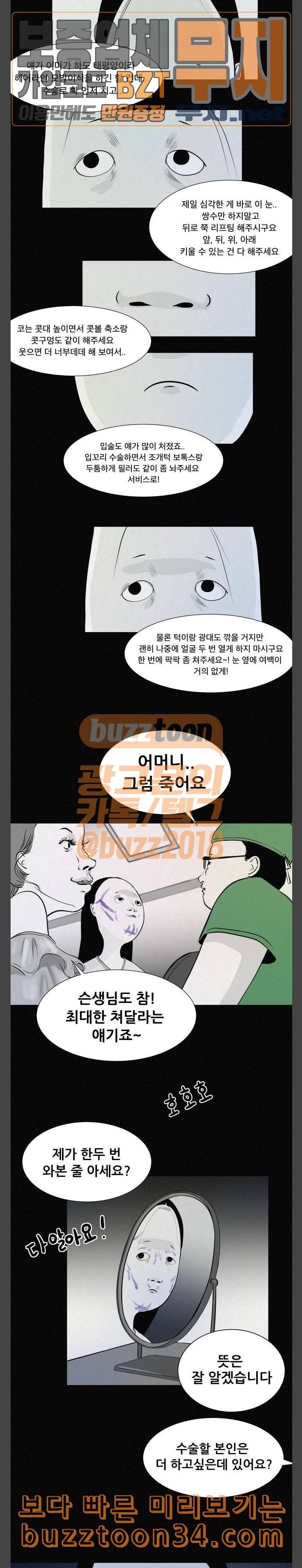 두번째 생일 성형수술 3