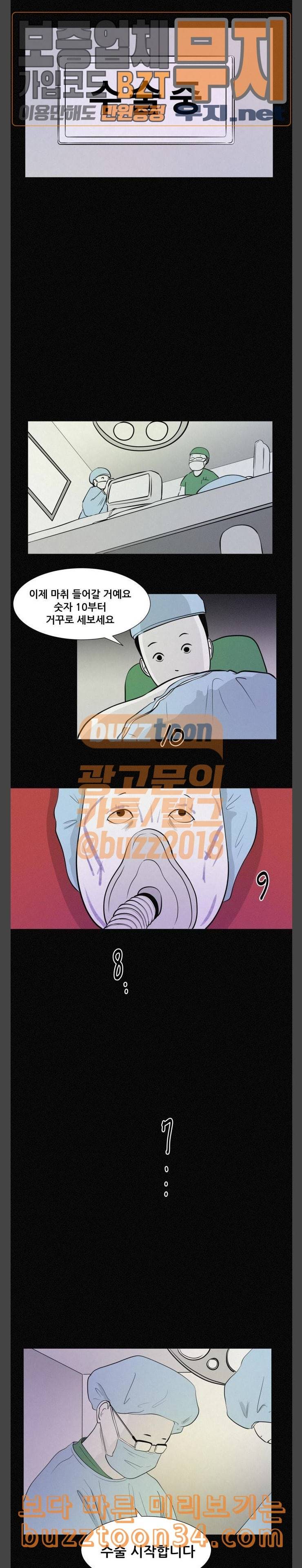 두번째 생일 성형수술 5