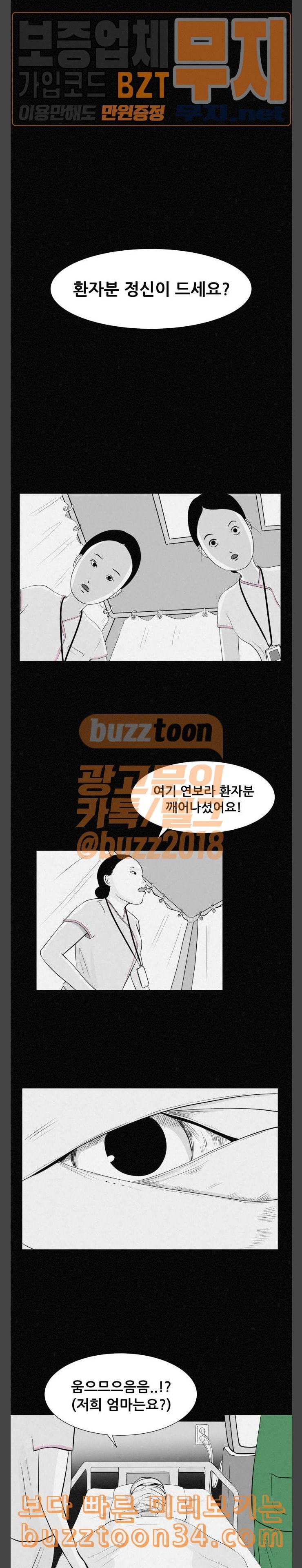 두번째 생일 성형수술 7
