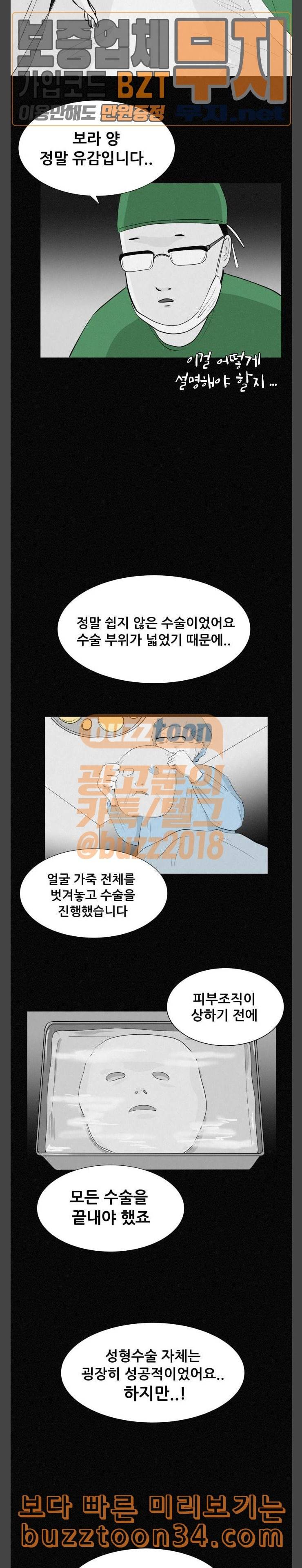 두번째 생일 성형수술 8
