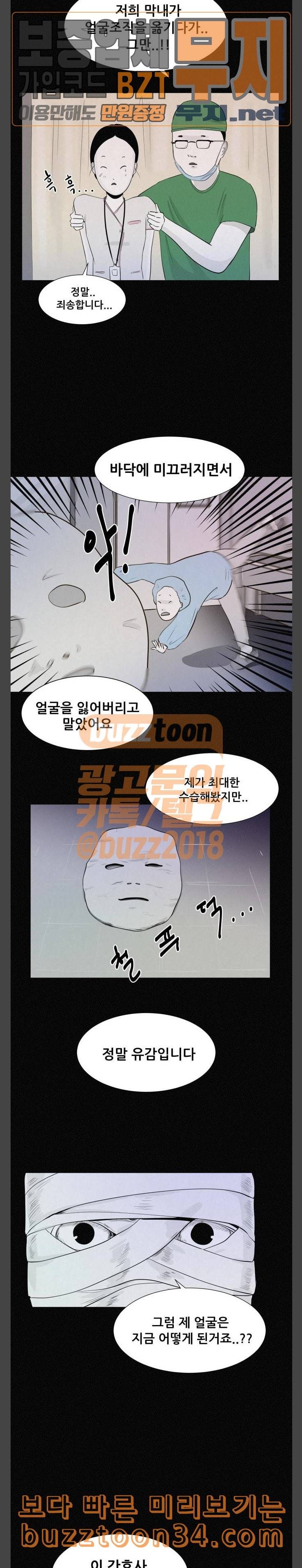 두번째 생일 성형수술 9