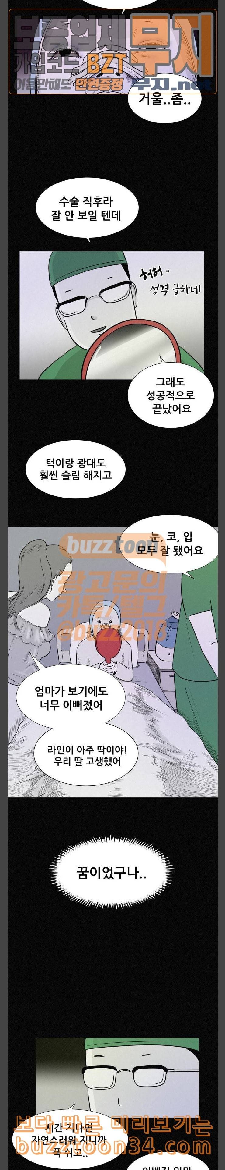 두번째 생일 성형수술 12