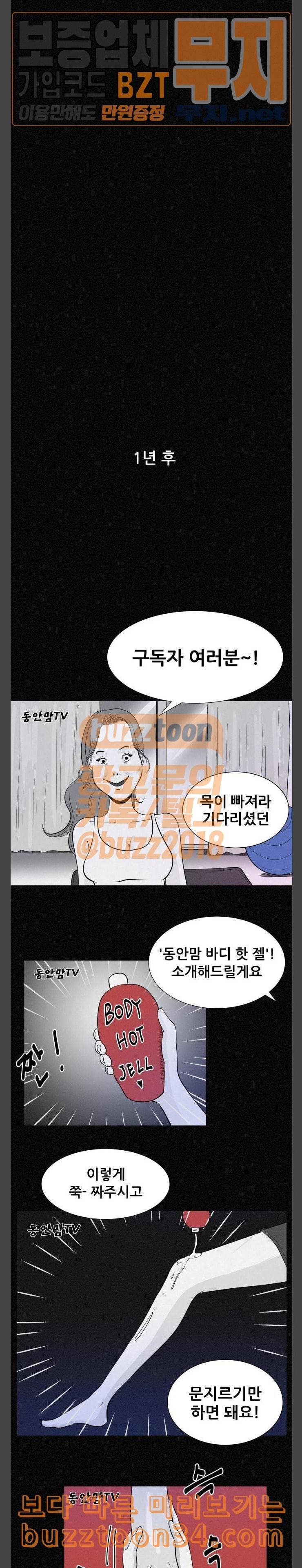 두번째 생일 성형수술 14