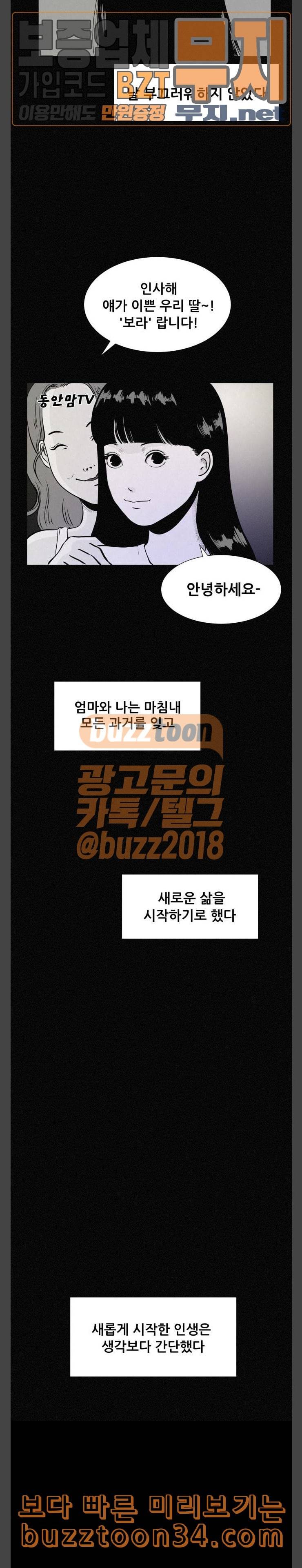 두번째 생일 성형수술 16