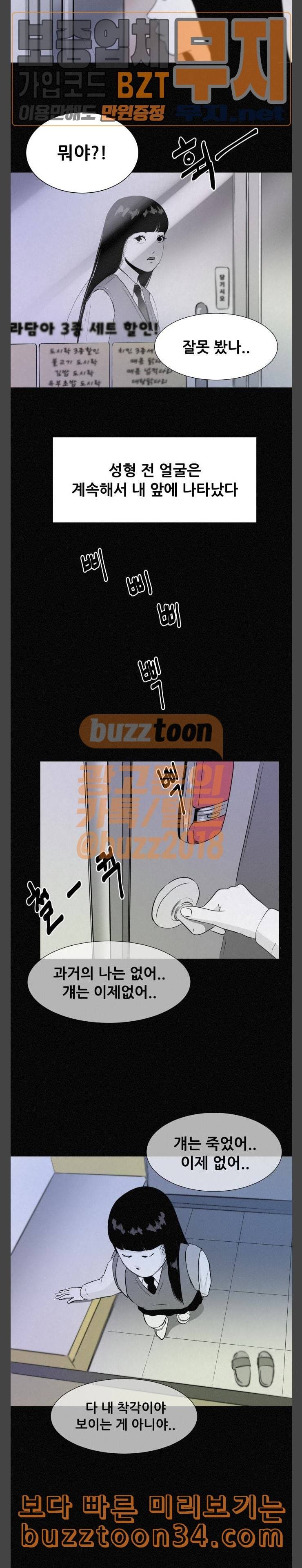 두번째 생일 성형수술 19