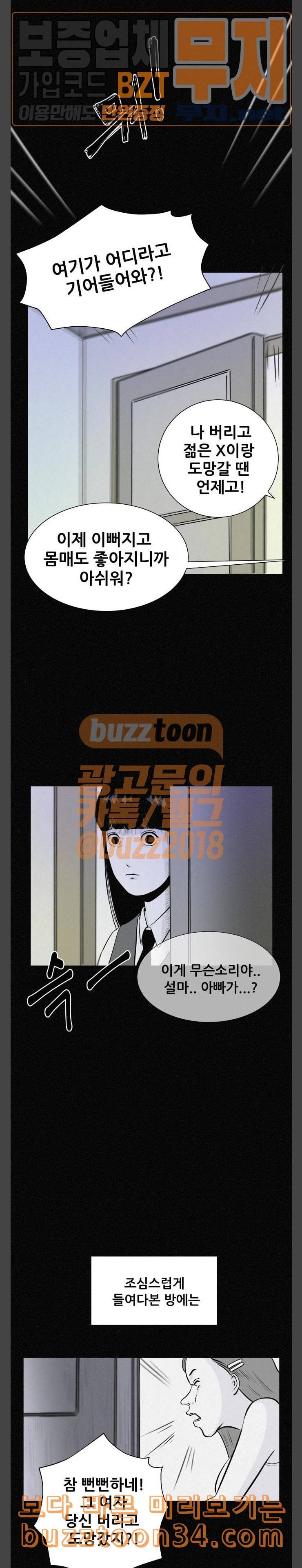두번째 생일 성형수술 20