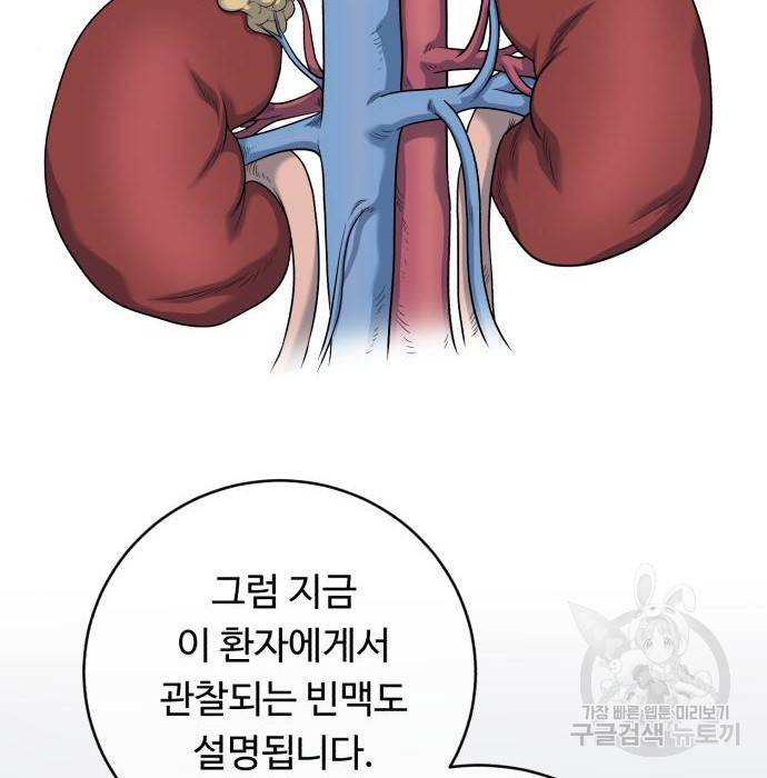A.I. 닥터 80화 147