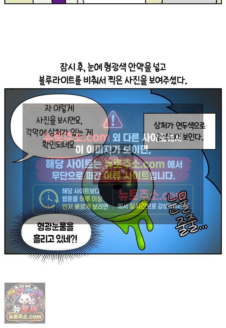 극한견주 시즌2 42화 눈병 치료(1) 7